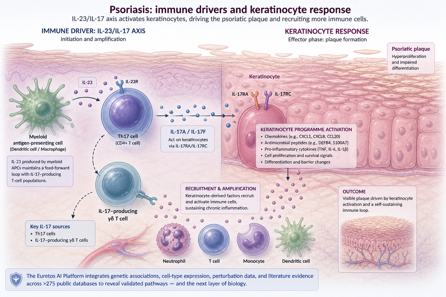psoriasis